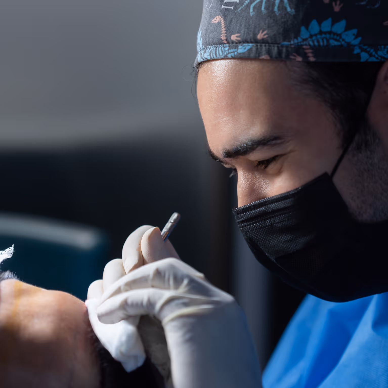 Close-up of the nano-needle implantation tool used at Estetime.