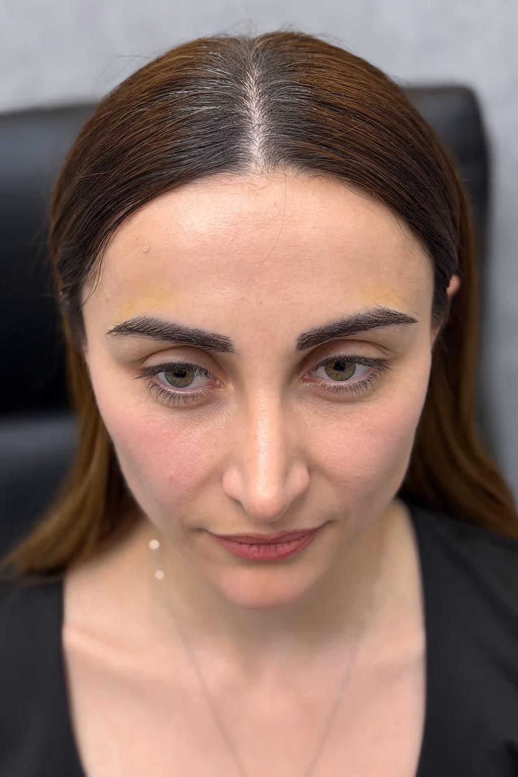 Estetime eyebrow transplant service.
