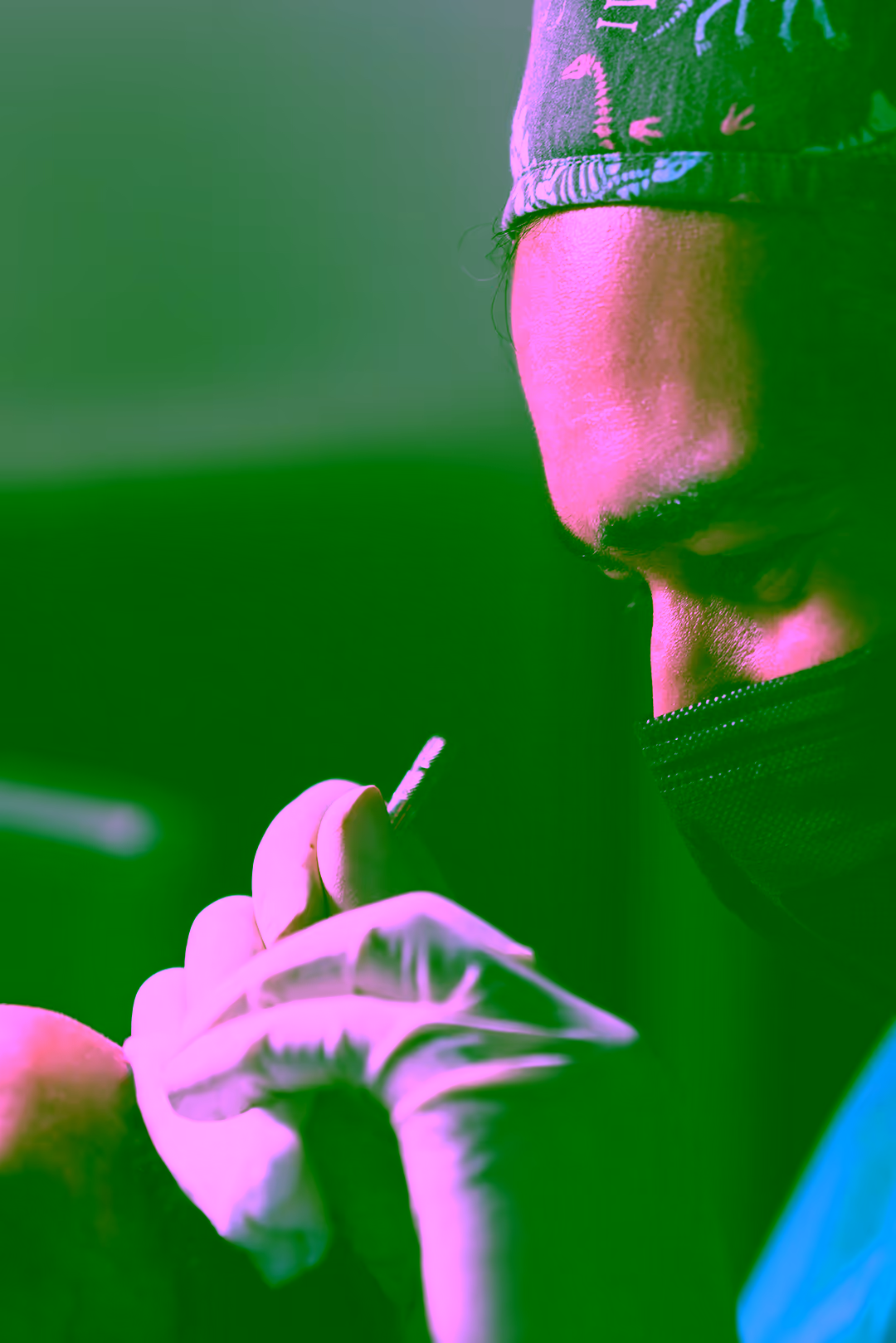 Estetime surgeon implanting grafts between full-length hair with a nano-needle during Long Hair FUE.